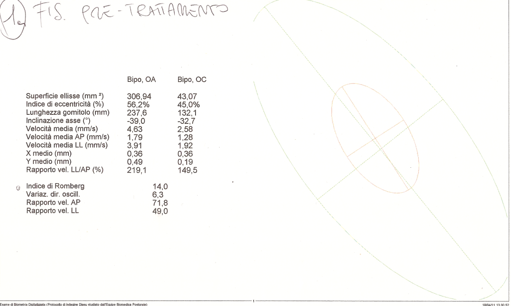 Stabilometria Fisiologica